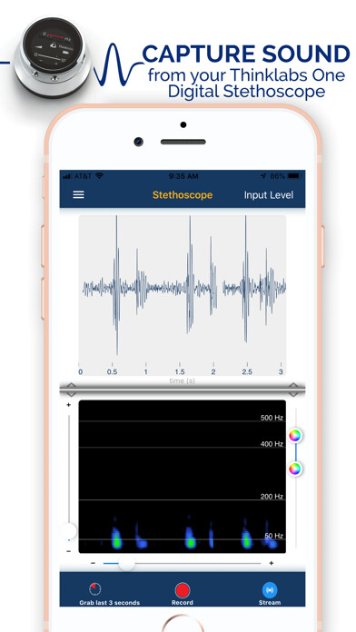 Emulate iPhone app Thinklabs Wave using MyAndroid Emulate iPhone app Thinklabs Wave using MyAndroid