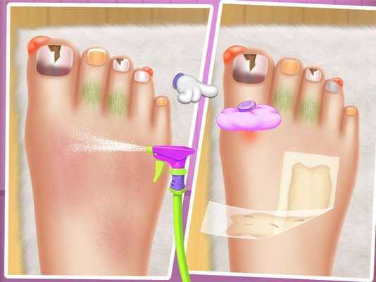 Emulate Android APK Toe Nail Doctor Salon Emulate Android APK Toe Nail Doctor Salon