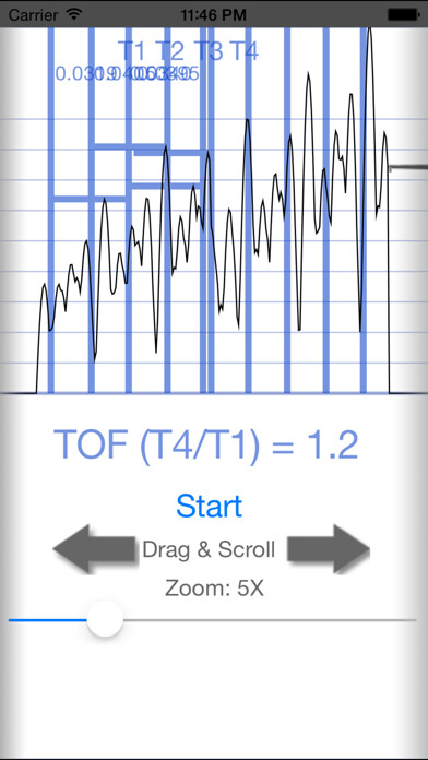 Emulate iPhone app Train of Four using MyAndroid Emulate iPhone app Train of Four using MyAndroid