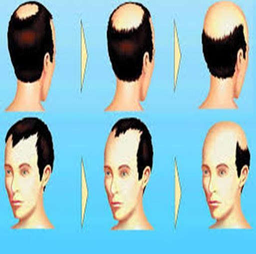 Emulate Android APK Tratamiento para Cabello Seco