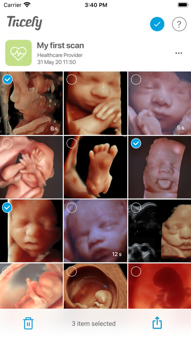 Emulate iPhone app Tricefy - for Patients using MyAndroid