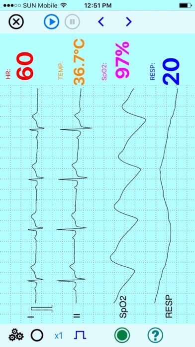 Emulate iPhone app UltraLS ECG SpO2 TEMP using MyAndroid Emulate iPhone app UltraLS ECG SpO2 TEMP using MyAndroid