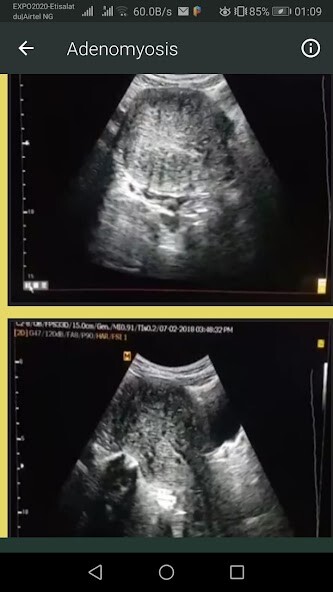 Run android online APK Ultrasound Guide from MyAndroid or emulate Ultrasound Guide using MyAndroid