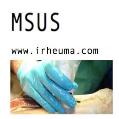 Emulate Android APK Ultrasound QIR