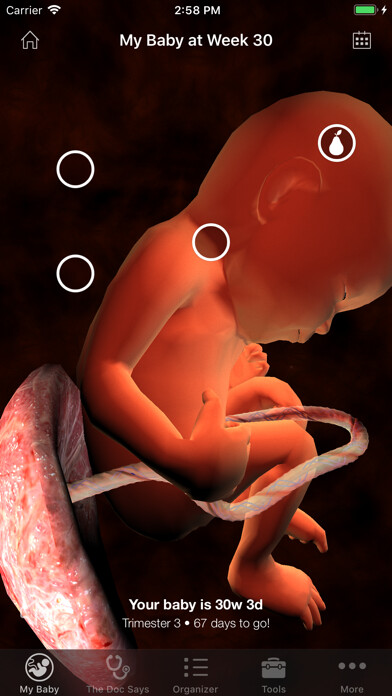 Emulate iPhone app UMC Pregnancy using MyAndroid Emulate iPhone app UMC Pregnancy using MyAndroid