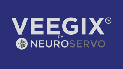 Emulate iPhone app VEEGix EEG using MyAndroid Emulate iPhone app VEEGix EEG using MyAndroid