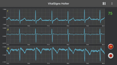 Emulate iPhone app VitalSign Holter using MyAndroid Emulate iPhone app VitalSign Holter using MyAndroid