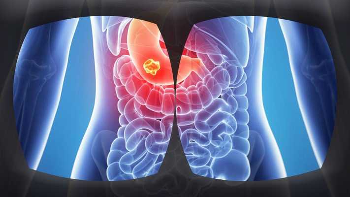 Emulate Android APK VR 360 Inside Human Body 3D Atlas ( Anatomy ) Emulate Android APK VR 360 Inside Human Body 3D Atlas ( Anatomy )
