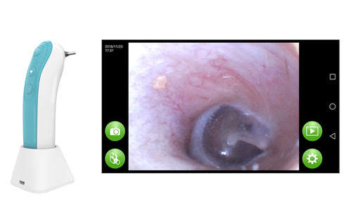 Run android online APK WIFI otoscope from MyAndroid or emulate WIFI otoscope using MyAndroid