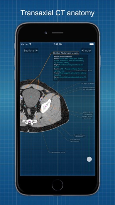 Emulate iPhone app X-Anatomy Basic using MyAndroid Emulate iPhone app X-Anatomy Basic using MyAndroid