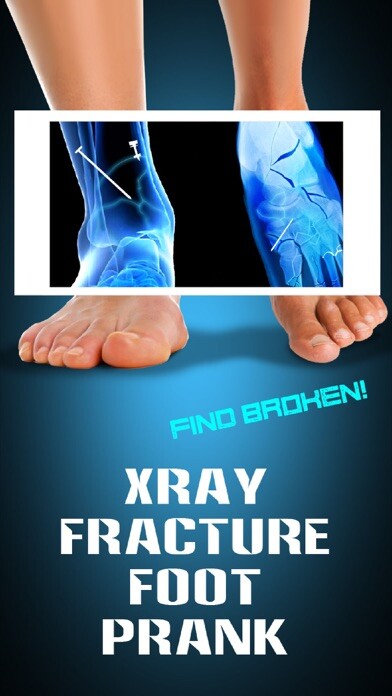 Emulate iPhone app Xray Fracture Foot Prank using MyAndroid Emulate iPhone app Xray Fracture Foot Prank using MyAndroid