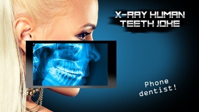 Emulate iPhone app X-Ray Human Teeth Joke using MyAndroid Emulate iPhone app X-Ray Human Teeth Joke using MyAndroid
