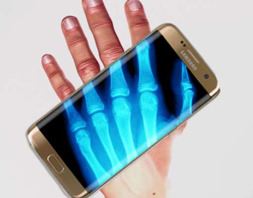 Emulate Android APK Xray Radiology Scanner Emulate Android APK Xray Radiology Scanner