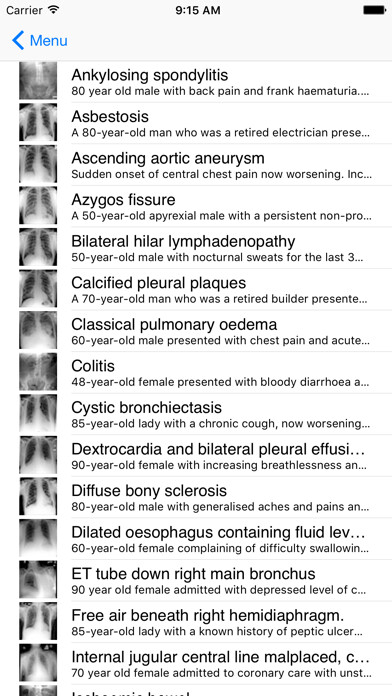 Emulate iPhone app Xrays4Medics using MyAndroid Emulate iPhone app Xrays4Medics using MyAndroid