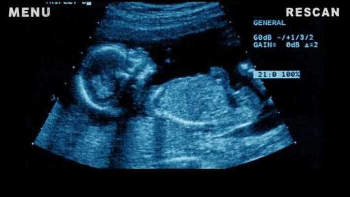 Emulate Android APK X-Ray Scanner Pregnant Joke