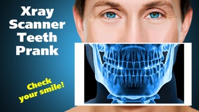 Emulate iPhone app Xray Scanner Teeth Prank using MyAndroid Emulate iPhone app Xray Scanner Teeth Prank using MyAndroid
