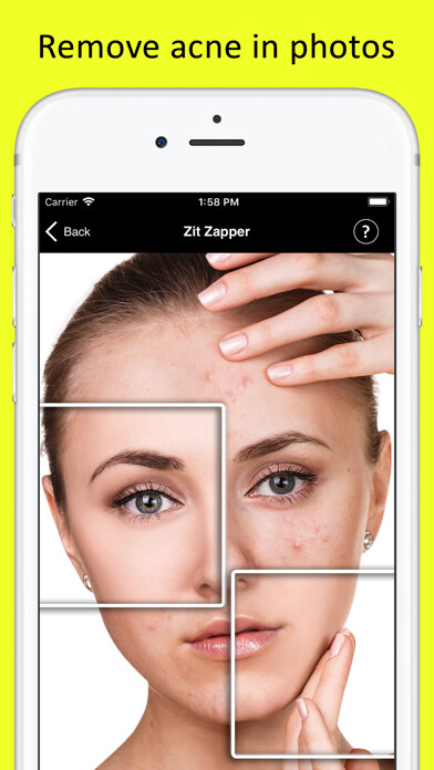 Emulate iPhone app Zit Zapper - Remove Pimples using MyAndroid Emulate iPhone app Zit Zapper - Remove Pimples using MyAndroid